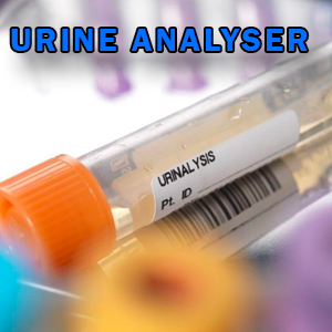 URINE ANALYSER